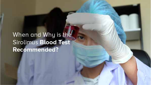 When and Why is the Sirolimus Blood Test Recommended?